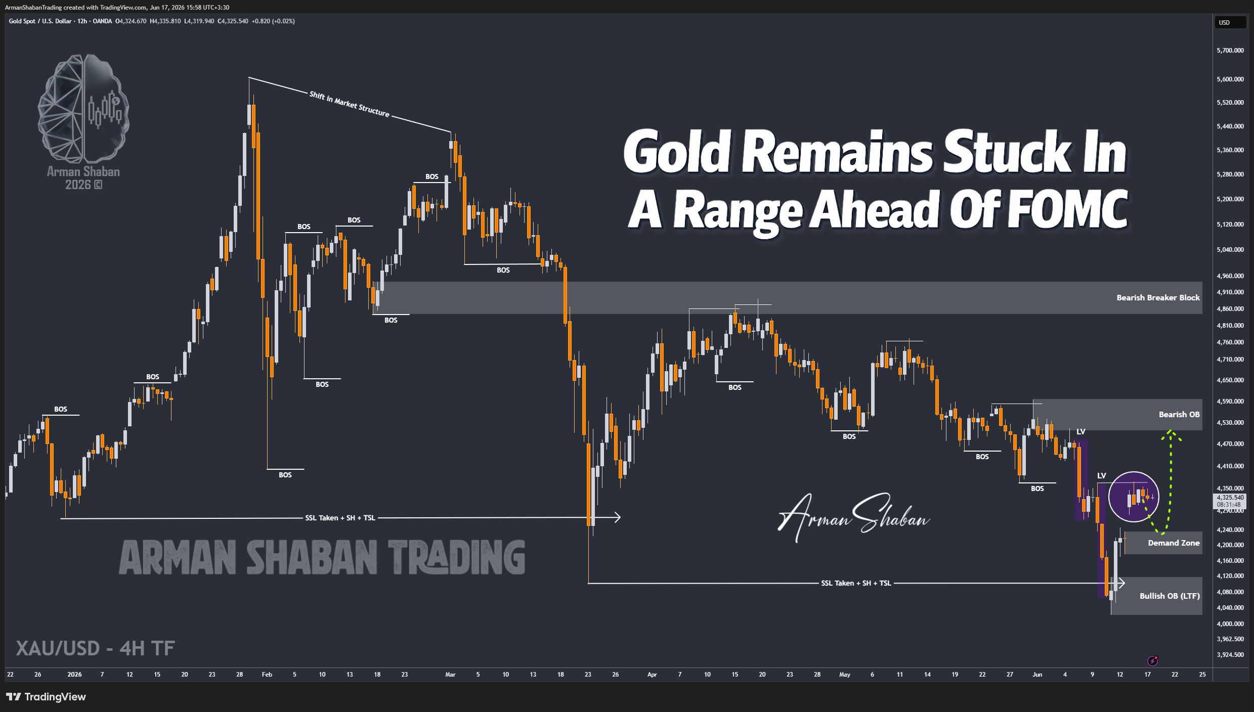 XAUUSD GOLD EURUSD GBPUSD Forex Gold Master Arman Shaban