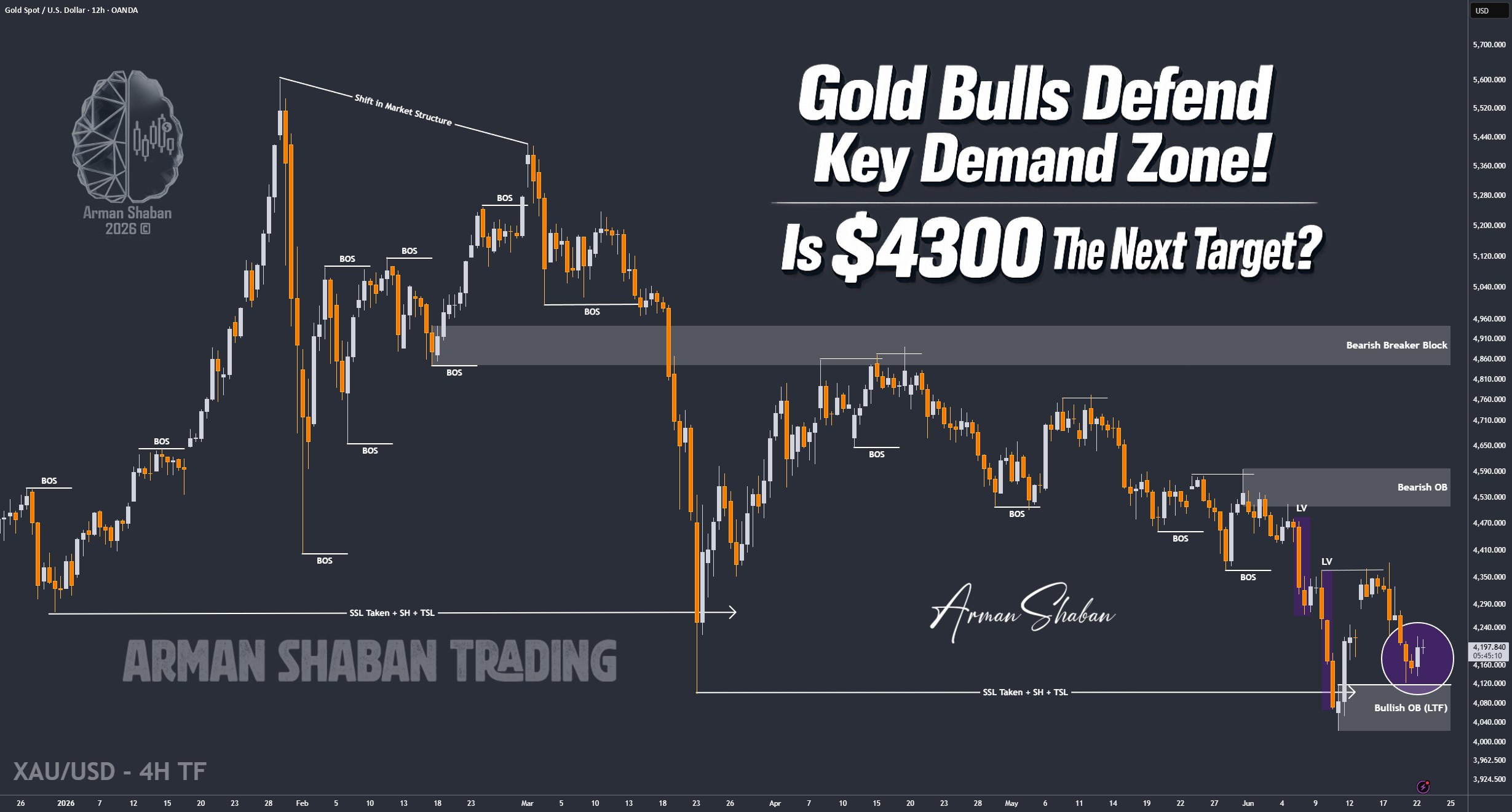 XAUUSD GOLD EURUSD GBPUSD Forex Gold Master Arman Shaban